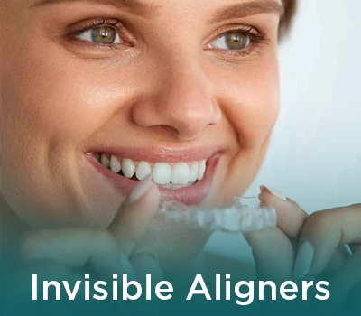 Invisible Aligners