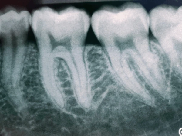 Panoramic X-RAY in Karachi