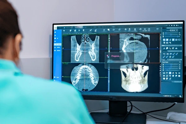 3D CBCT X-Rays