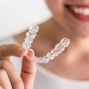 transparent retainers